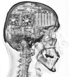 CT scan showing technology implemented within the brain.